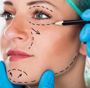 Procedure