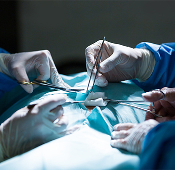 Procedure